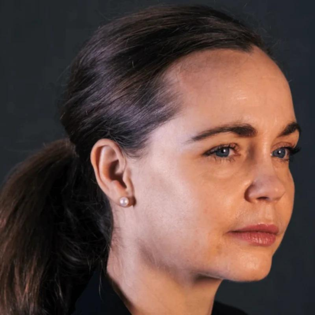 Omnia RU761-DRWC Hearing Aids